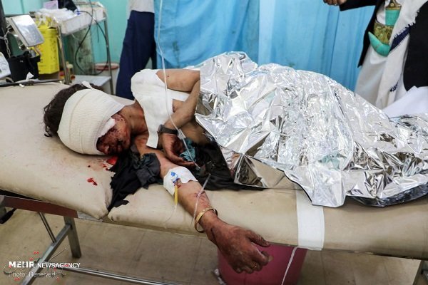 عربستان با بمب ساخت کدام کشور کودکان یمنی را به شهادت رساند؟